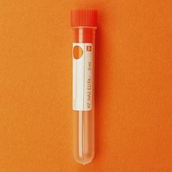 Skúmavka 12×75, KF+Na2EDTA pre 5 ml krvi